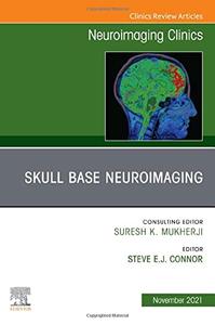 Skull Base Neuroimaging, An Issue of Neuroimaging Clinics of North America For Sale Cheap Online
