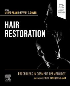 Procedures in Cosmetic Dermatology: Cosmetic Hair Restoration Cheap Store