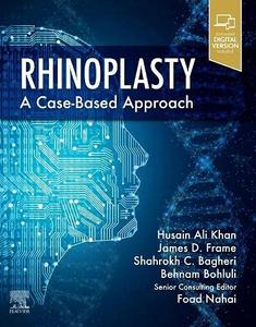 Rhinoplasty: a Case-based approach Free Shipping Best Seller