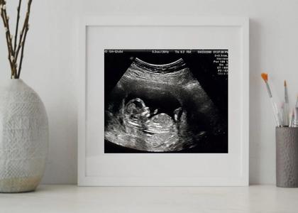 Baby Ultrasound Sonogram Picture Frame for grandparents for dad Perfect Cheap Online