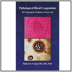 Pathological Blood Coagulation: The Myxotoxic Oxidative Stress Test - Booklet Cheap Store