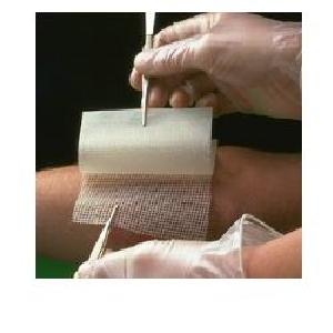 Garza Bactigras 10x10cm 10pz Outlet Free Shipping Authentic
