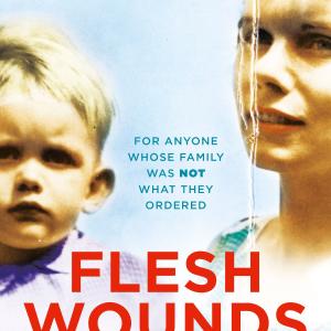 Flesh Wounds Sale Wholesale Pice