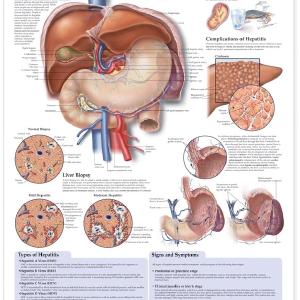 Understanding Hepatitis Anatomical Chart Laminated Cheap Sale Amazon