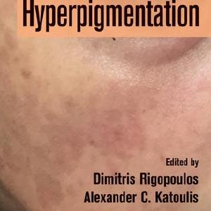 Hyperpigmentation - Hardback Ebay