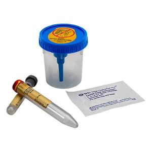 BD Vacutainer Complete Urine Collection Kit Best Deals