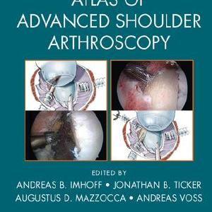 Atlas of Advanced Shoulder Arthroscopy - Hardback Best Seller