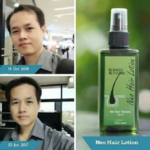 10X Neo Hair Lotion Root Original Nutrients Longer Hair Treatment 120 ml. Best Selling Sale 2025