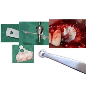 Membrane Punch Finishline For Sale