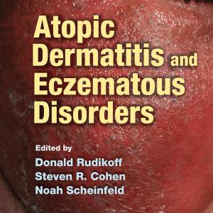 Atopic Dermatitis and Eczematous Disorders Cheap Sale Sast