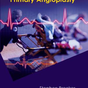 Clinical Guide to Primary Angioplasty Outlet Locations Cheap Pice