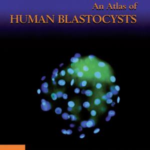 Atlas of Human Blastocysts Clearance 2025