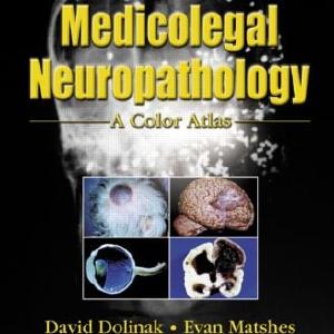 Medicolegal Neuropathology - Hardback Outlet Amazon