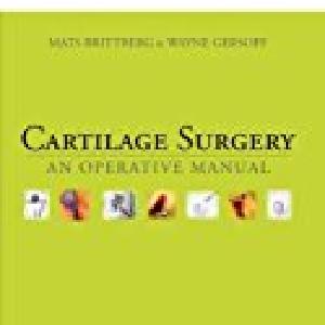 Cartilage Surgery: An Operative Manual, Expert Consult: Online and Print With Mastercard Online