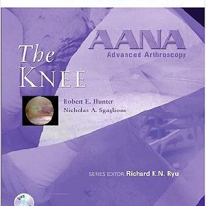 AANA Advanced Arthroscopy: The Knee: Expert Consult: Online, Print and DVD Footaction Online