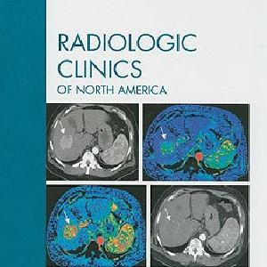 Advanced CT Applications, An Issue of Radiologic Clinics Geniue Stockist