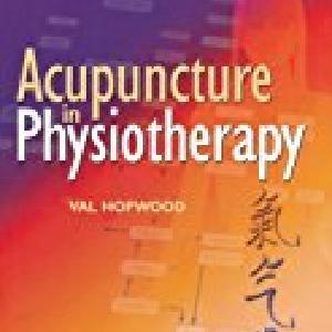 Acupuncture in Physiotherapy 2025 New Sale Online