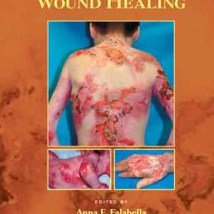 Wound Healing - Paperback / softback Cheap Sale 100% Guaranteed