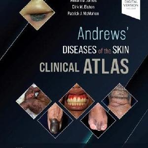 Andrews' Diseases of the Skin Clinical Atlas Cheap Usa Stockist