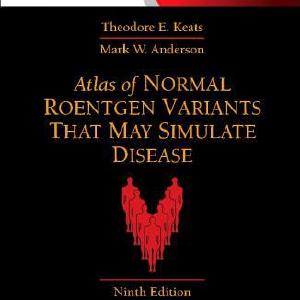 Atlas of Normal Roentgen Variants That May Simulate Disease:Expert Con Cheap Low Shipping Fee