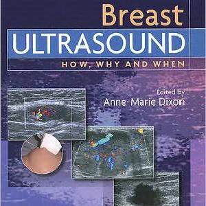 Breast Ultrasound:How, Why and When:How, Why and When Clearance Affordable