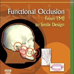 Functional Occlusion:From TMJ to Smile Design Discount Shop For