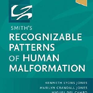 Smith's Recognizable Patterns of Human Malformation Cheap Best Wholesale