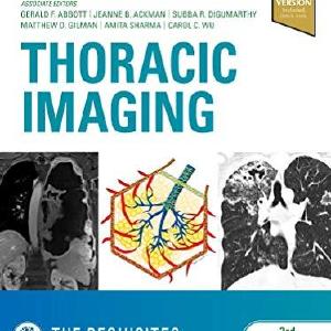 Thoracic Imaging The Requisites:Requisites in Radiology Discount Manchester
