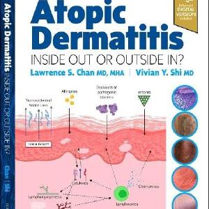 Atopic Dermatitis: Inside Out or Outside In Manchester Great Sale Cheap Pice