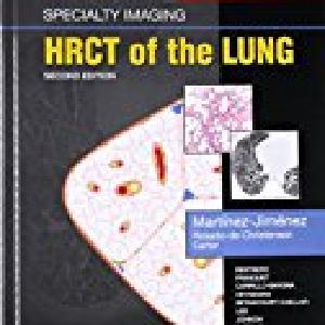 Specialty Imaging: HRCT of the Lung:Specialty Imaging Online Online Outlet Sale