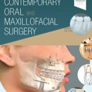 Contemporary Oral Maxillofacial Surg 7e 2025 Sale Online