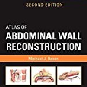 Atlas of Abdominal Wall Reconstruction Extremely For Sale
