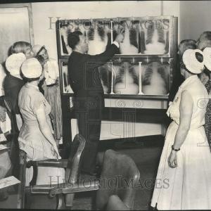 1955 Press Photo Suburban Cook County Tuberculosis Discount Big Discount