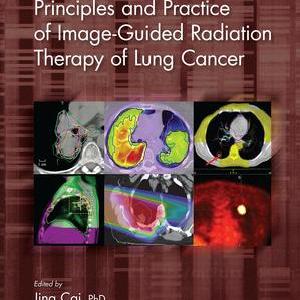 Principles and Practice of Image-Guided Radiation Therapy of Lung Cancer - Hardback Discount Best Store To Get