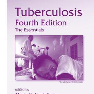 Tuberculosis Footlocker Pictures Sale Online