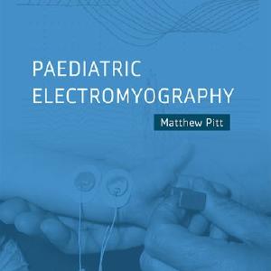 Paediatric Electromyography Purchase Cheap Pice