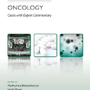 Challenging Concepts in Oncology Discount Big Discount