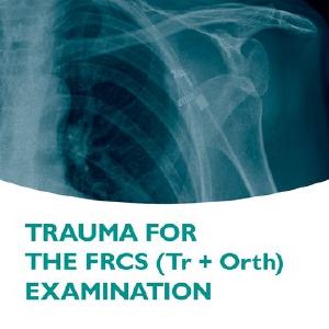 Trauma for the FRCS (Tr   Orth) Examination Manchester For Sale