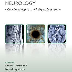 Challenging Concepts in Neurology Cheap Sale Shop For