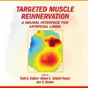 Targeted Muscle Reinnervation - Paperback / softback 2025 Unisex