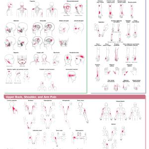 Travell, Simons & Simons Trigger Point Pain Patterns Wall      Chart Sale Cheapest Pice