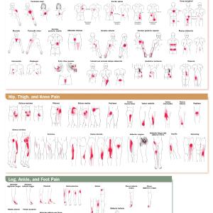 Travell, Simons & Simons Trigger Point Pain Patterns Wall      Chart Recommend For Sale