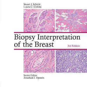 Biopsy Interpretation of the Breast Free Shipping Best Seller