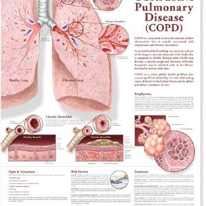 Chronic Obstructive Pulmonary Disease (COPD) Anatomical Chart   Paper Unmounted Affordable Online