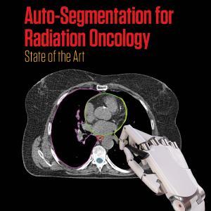 Auto-Segmentation for Radiation Oncology Outlet Store Cheap Pice