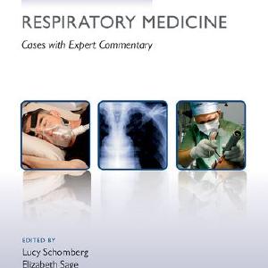 Challenging Concepts in Respiratory Medicine Best Sale For Sale