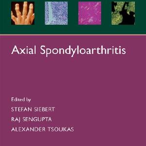 Axial Spondyloarthritis Discount Looking For