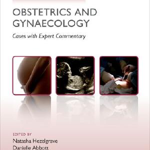 Challenging Concepts in Obstetrics and Gynaecology Discount Fashion Style