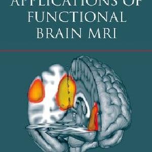 Clinical Applications of Functional Brain MRI Discount Free Shipping