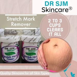 VuduSecrets Stretch Mark Cream Outlet Explore